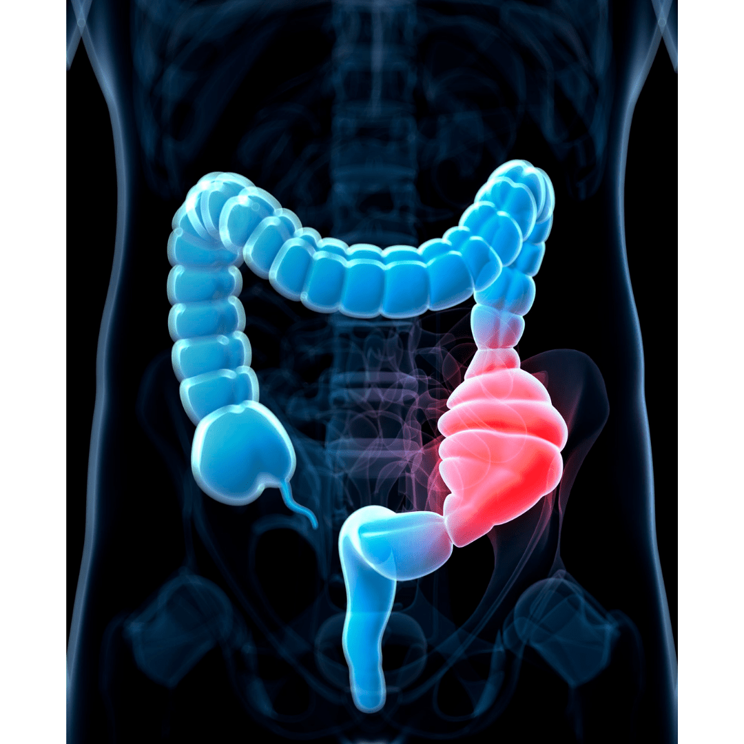 3 reasons why you could be constipated and 5 ways to relieve it